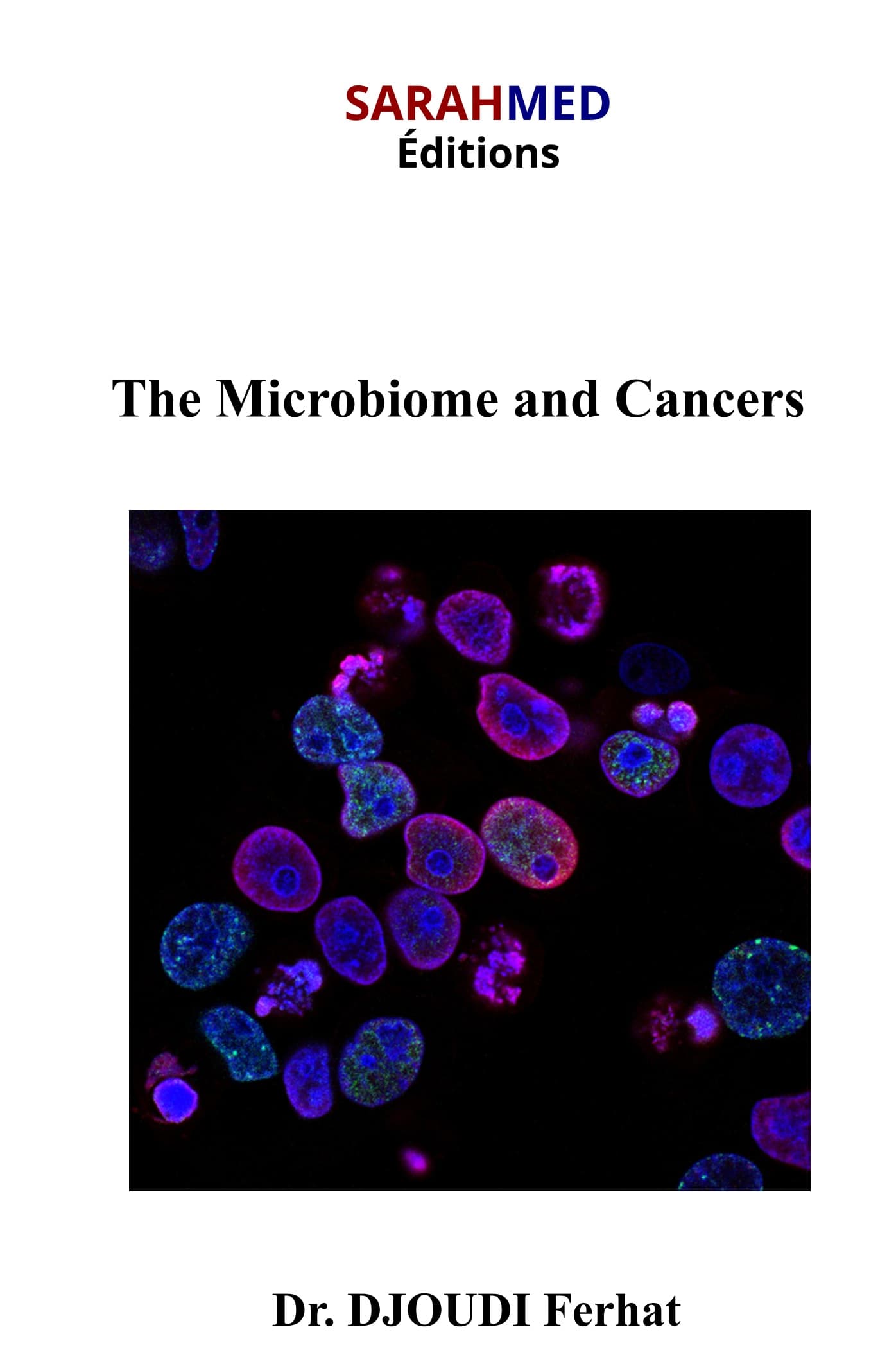 The Microbiome and Cancers